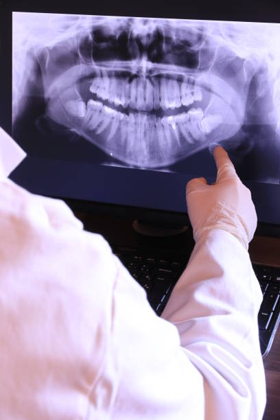 Best Emergency Dentist for Knocked-Out Tooth in Reedley, CA